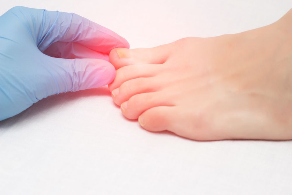 Foot Fungus Breakthrough: This Made a Noticeable Difference Fast
