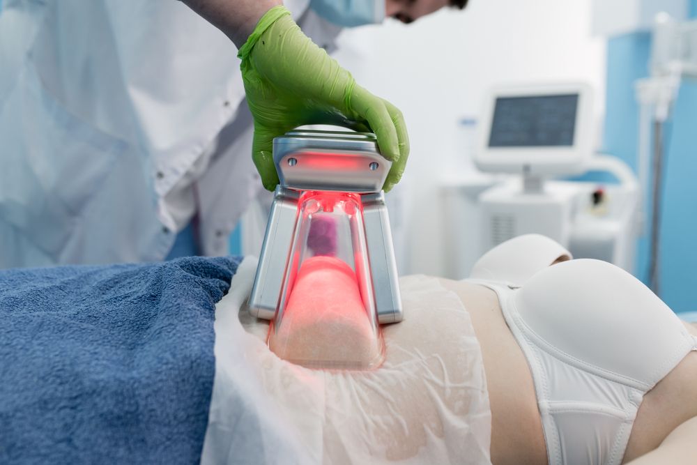 Non-Surgical Liposuction: A Painless Path to Your Desired Body