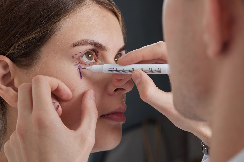Your Guide to Blepharoplasty: Understanding Eyelid Surgery