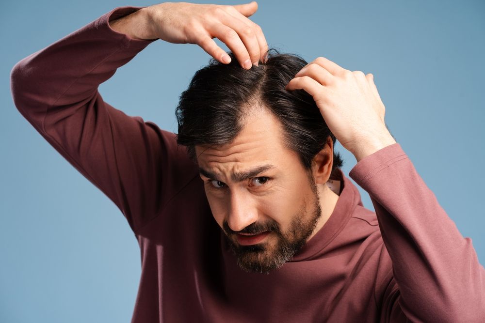 Flakes Be Gone! Dandruff & How to Treat It
