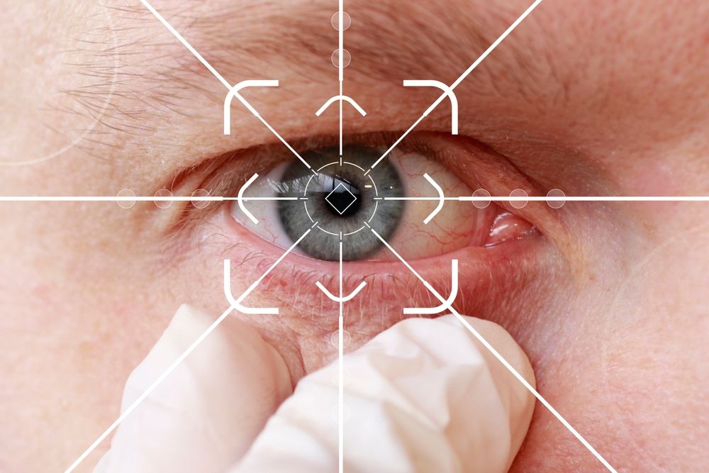 Cataract Surgery Explained: Here's What You Need to Know