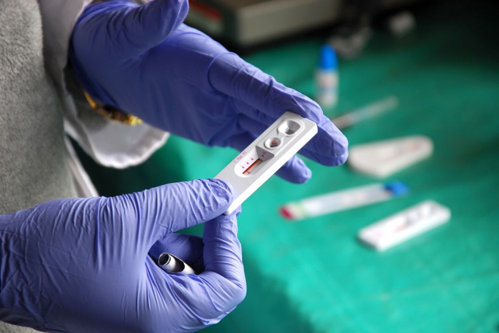 Understanding HIV: Symptoms and Treatment Options