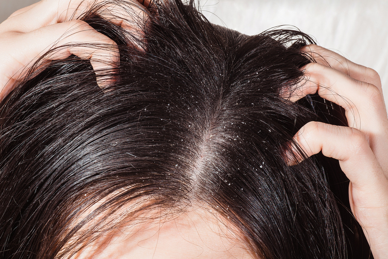 Ungüento para el cuero cabelludo | Shutterstock Photo by Goncharov_Artem