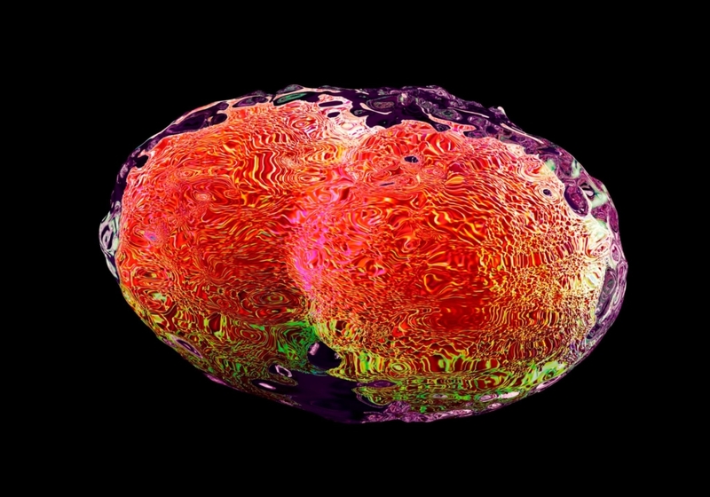 Life-Threatening Diseases | Getty Images Photo by SCIENCE ARTWORK/SCIENCE PHOTO LIBRARY