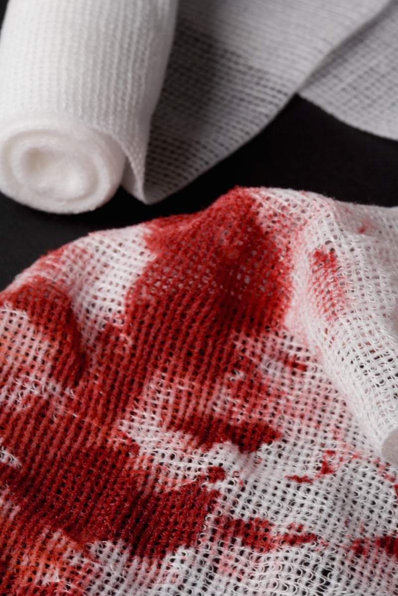 Lift Blood Stains | Getty Images Photo by Caspar Benson